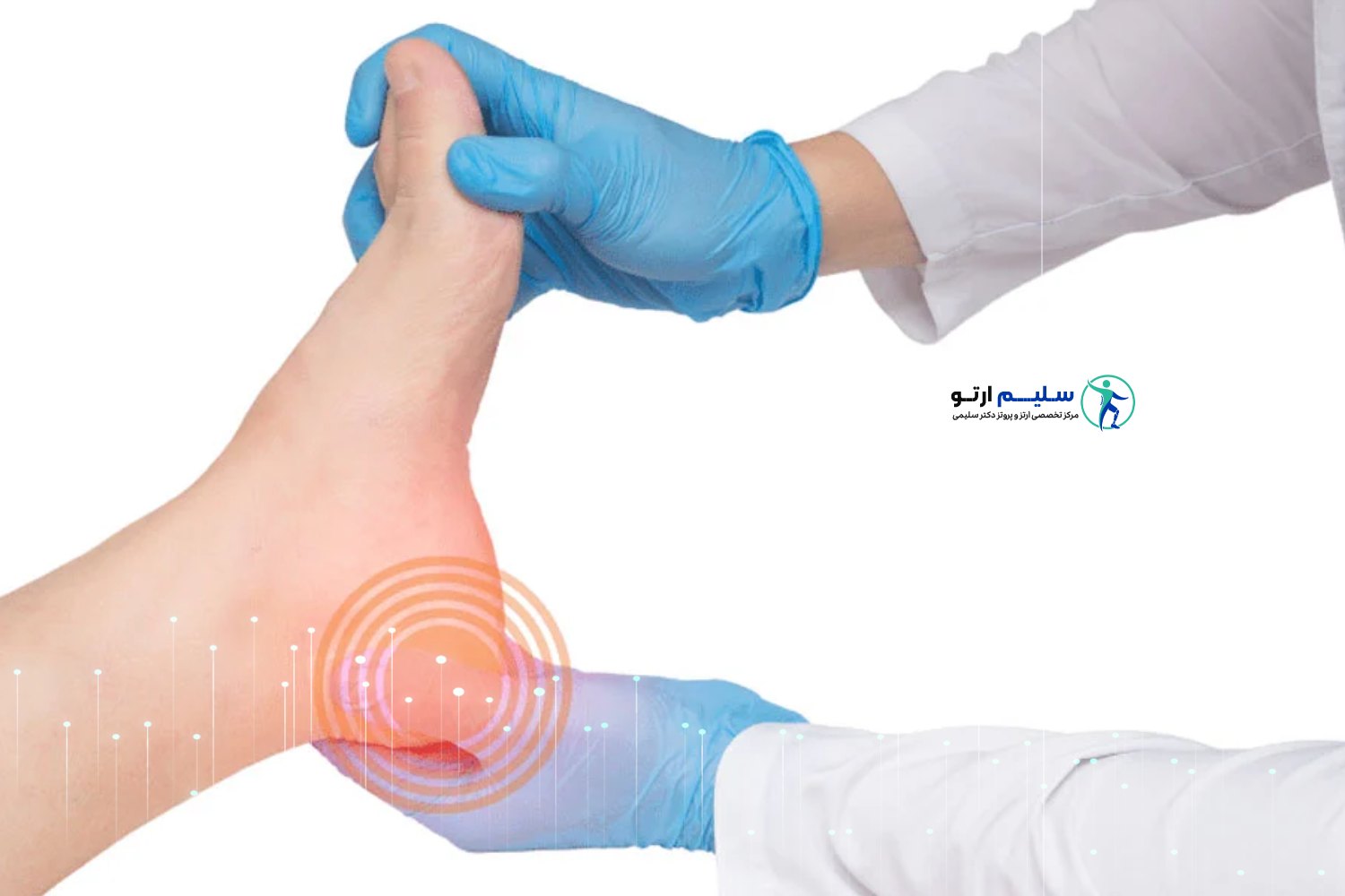 علائم خار پاشنه خار پاشنه چیست