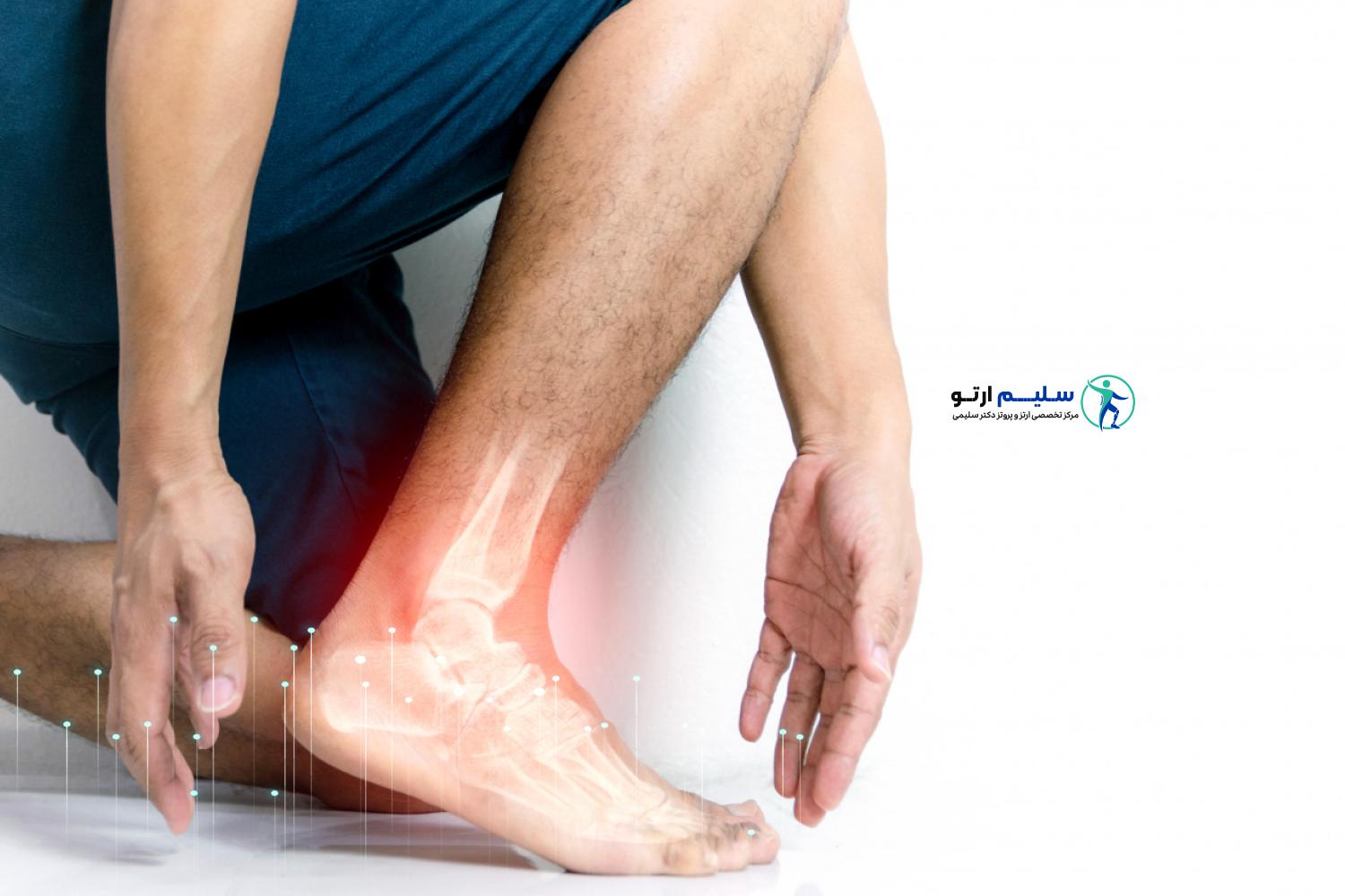 خار پاشنه از چی بوجود میاد؟ دلایل اصلی خار پاشنه