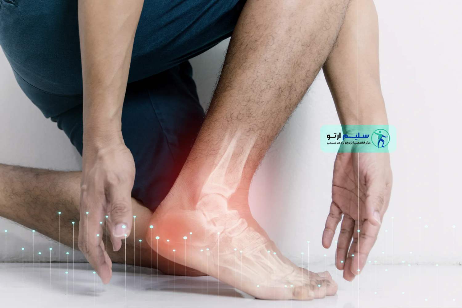 آیا خار پاشنه خطرناک است؟ عکس درد پاشنه پا به علت خار پاشنه