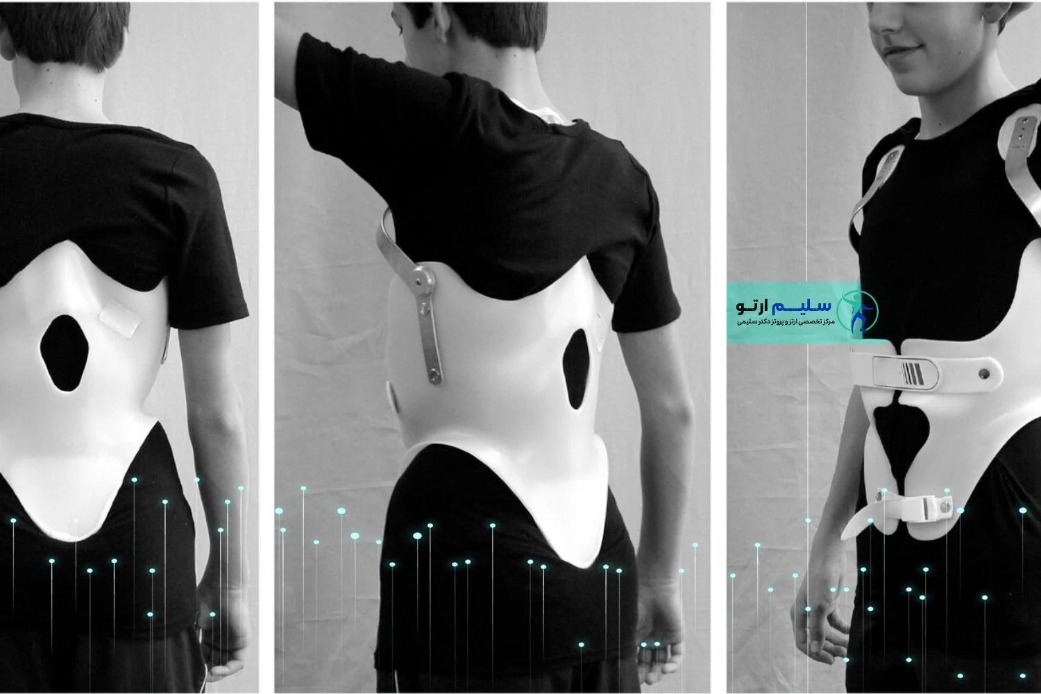 kyphologic-belt-picture1 رزرو آنلاین وقت ساخت کمربند کایفولوژیک در سلیم ارتو