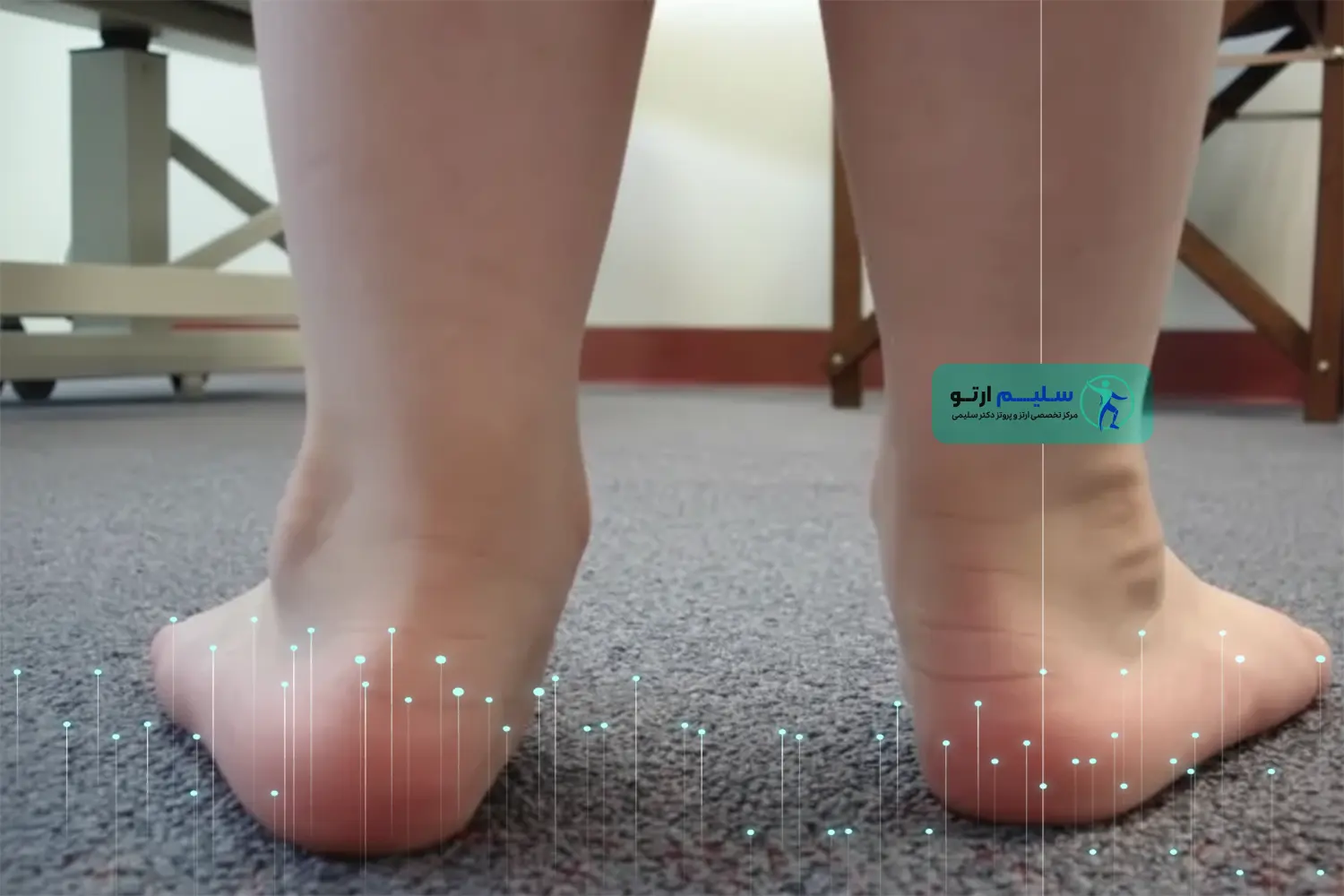 چرخش مچ پا به داخل (Pronation) در کودکان و دانش آموزان: راهکارهای سلیم ارتو برای گام‌هایی مطمئن