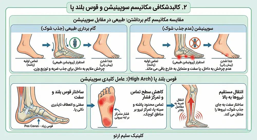 چرخش مچ پا به خارج کالبدشکافی مکانیسم سوپینیشن و قوس بلند پا